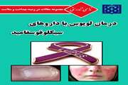 ندای تندرستی/درمان لوپوس با داروهای سیکلوفوسفامید
